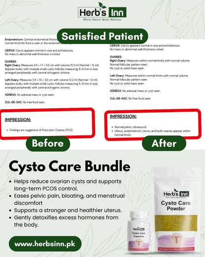 Cysto Care Bundle - (2 Products in 1 Price) Best for PCOS